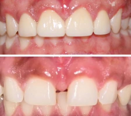 Before & After Transformation 1
