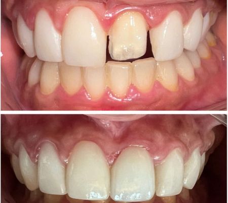 Before & After Transformation 2