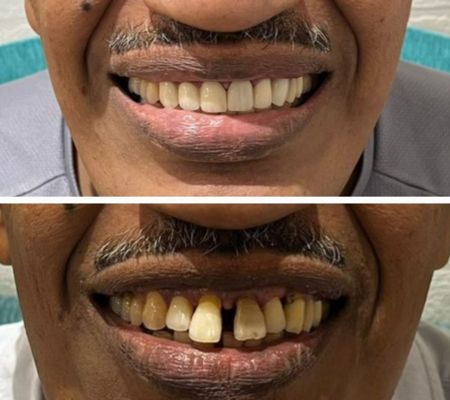 Before & After Transformation 3