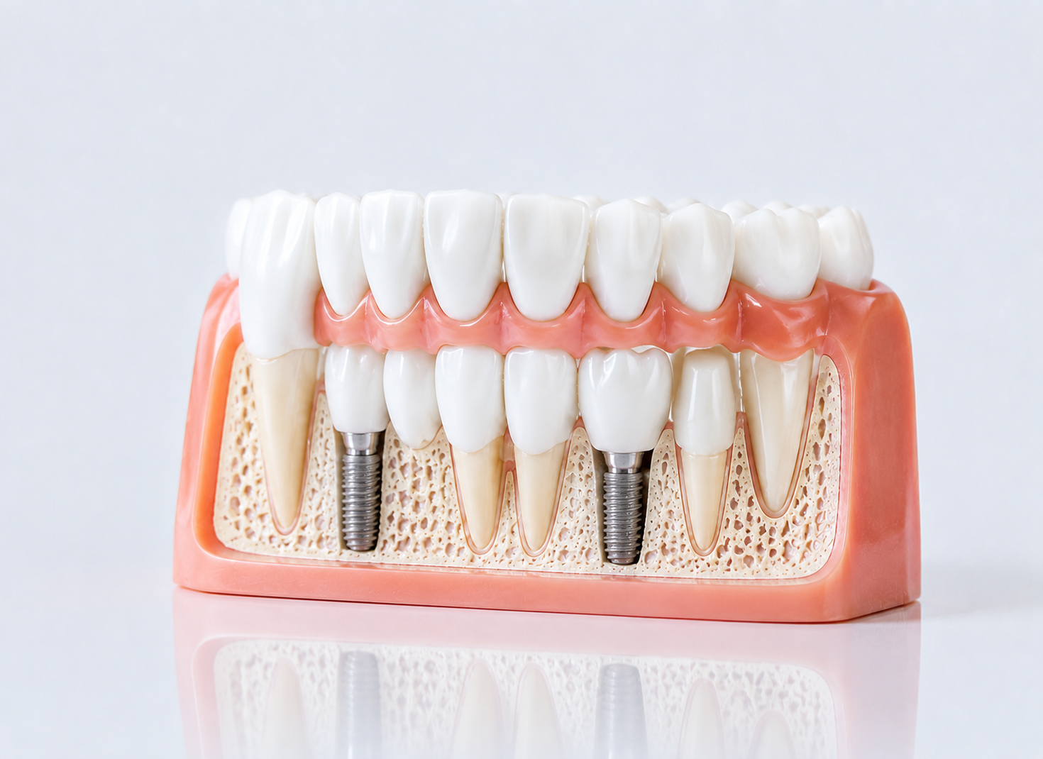 Full Mouth Rehabilitation – Dr. Devanand Shetty, Bandra Mumbai