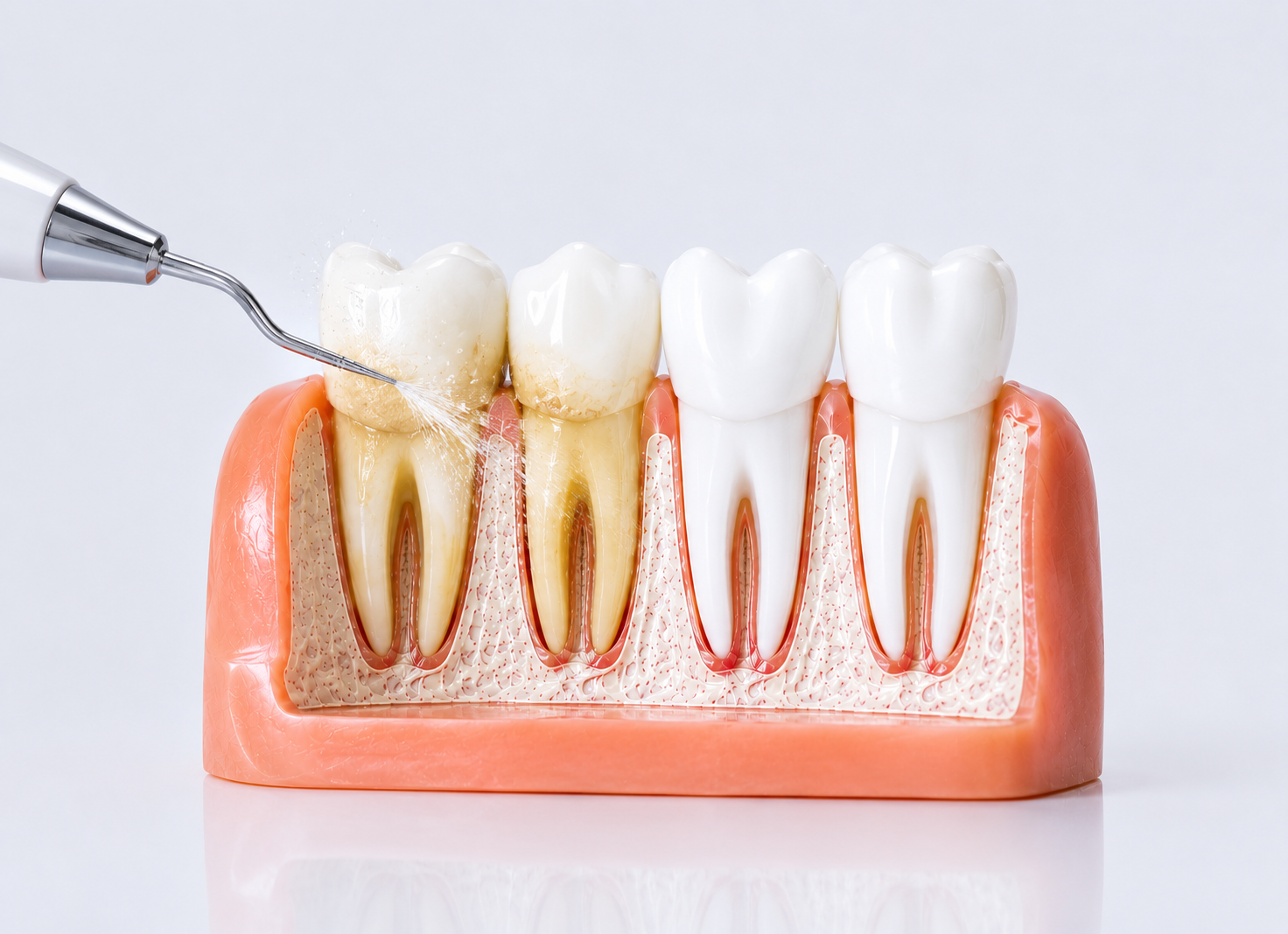 Best Oral Prophylaxis Clinic in Bandra Mumbai